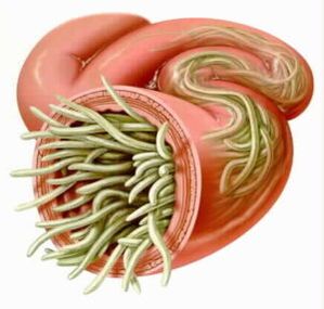 Parasites dans l'intestin