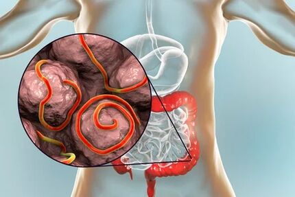 Parasites dans l'intestin